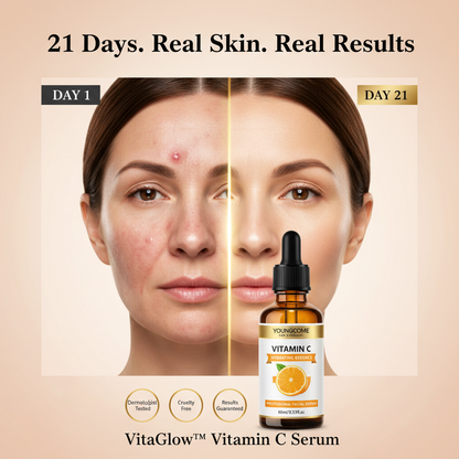 VitaGlow™- Anti-Wrinkle Serum with Vitamin C