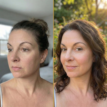 CollaPeel™ - Anti-Wrinkle, Acne Firming Mask