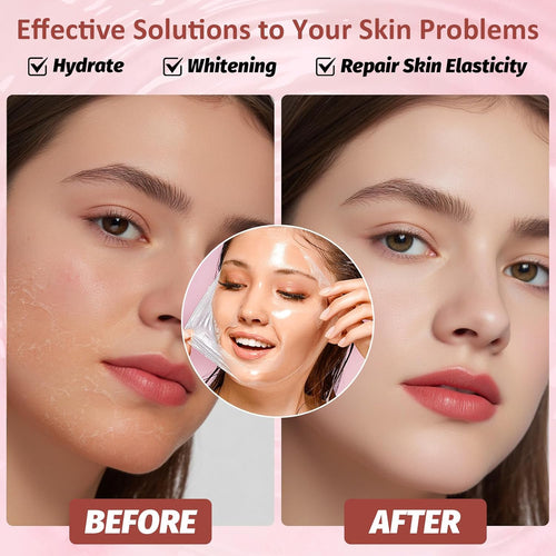 CollaPeel™ - Anti-Wrinkle, Acne Firming Mask