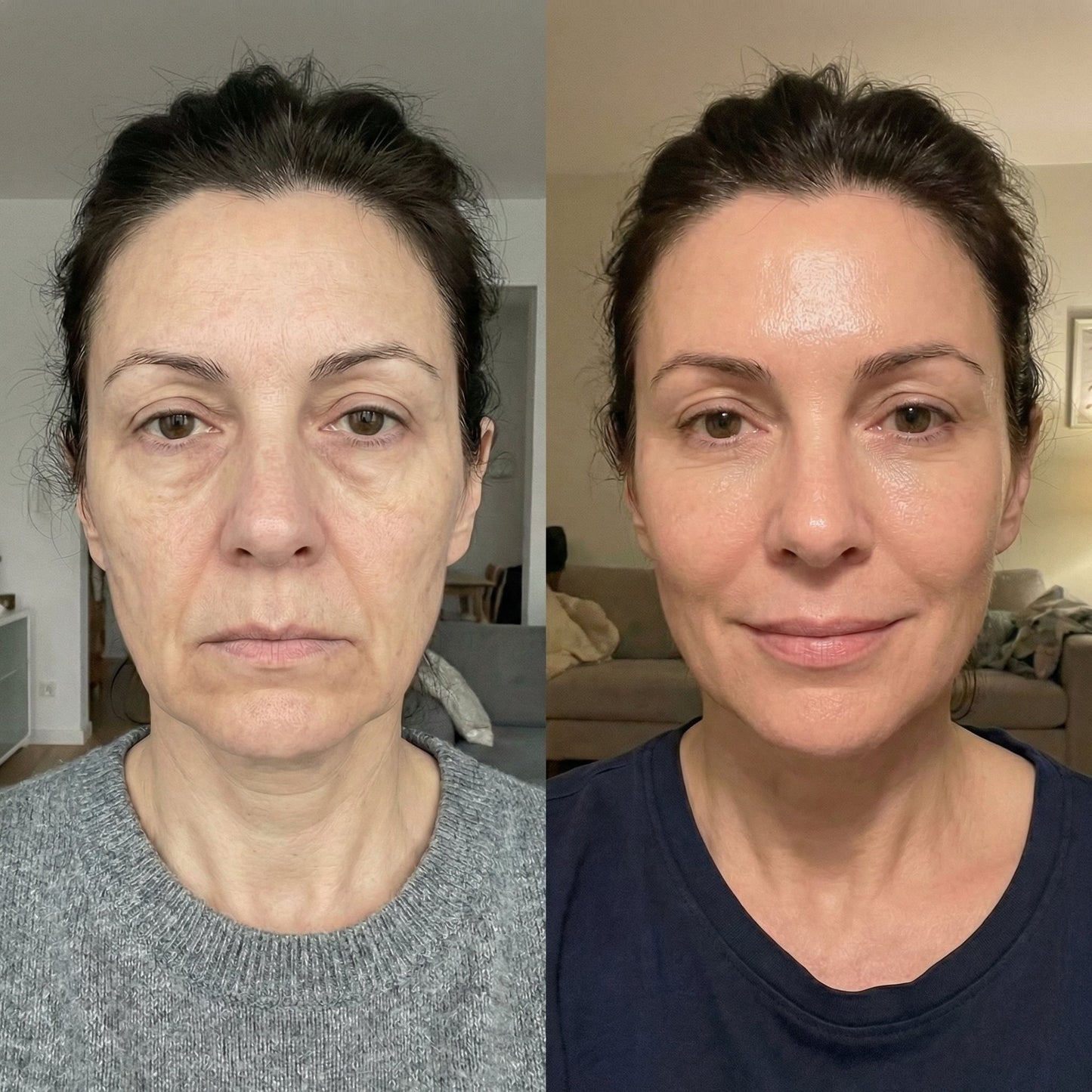 CollaPeel™ - Anti-Wrinkle, Acne Firming Mask